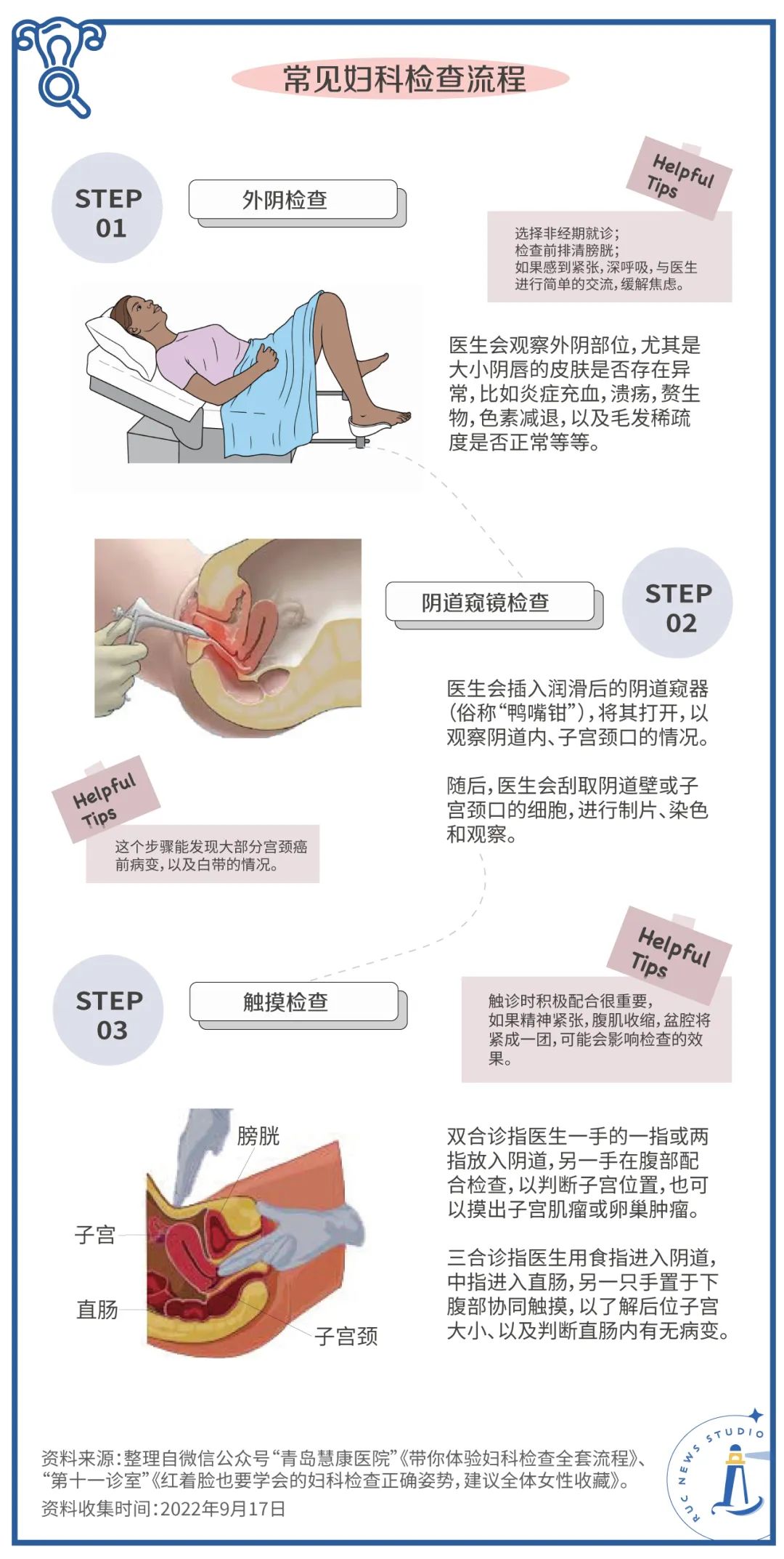 最新妇科流产技术及其对患者的影响探究